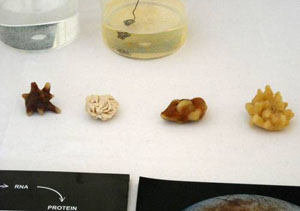 Analiza chimică a pietrelor urinare de la rinichi.  Analiza pietrelor la rinichi: ce teste pentru urolitiază.